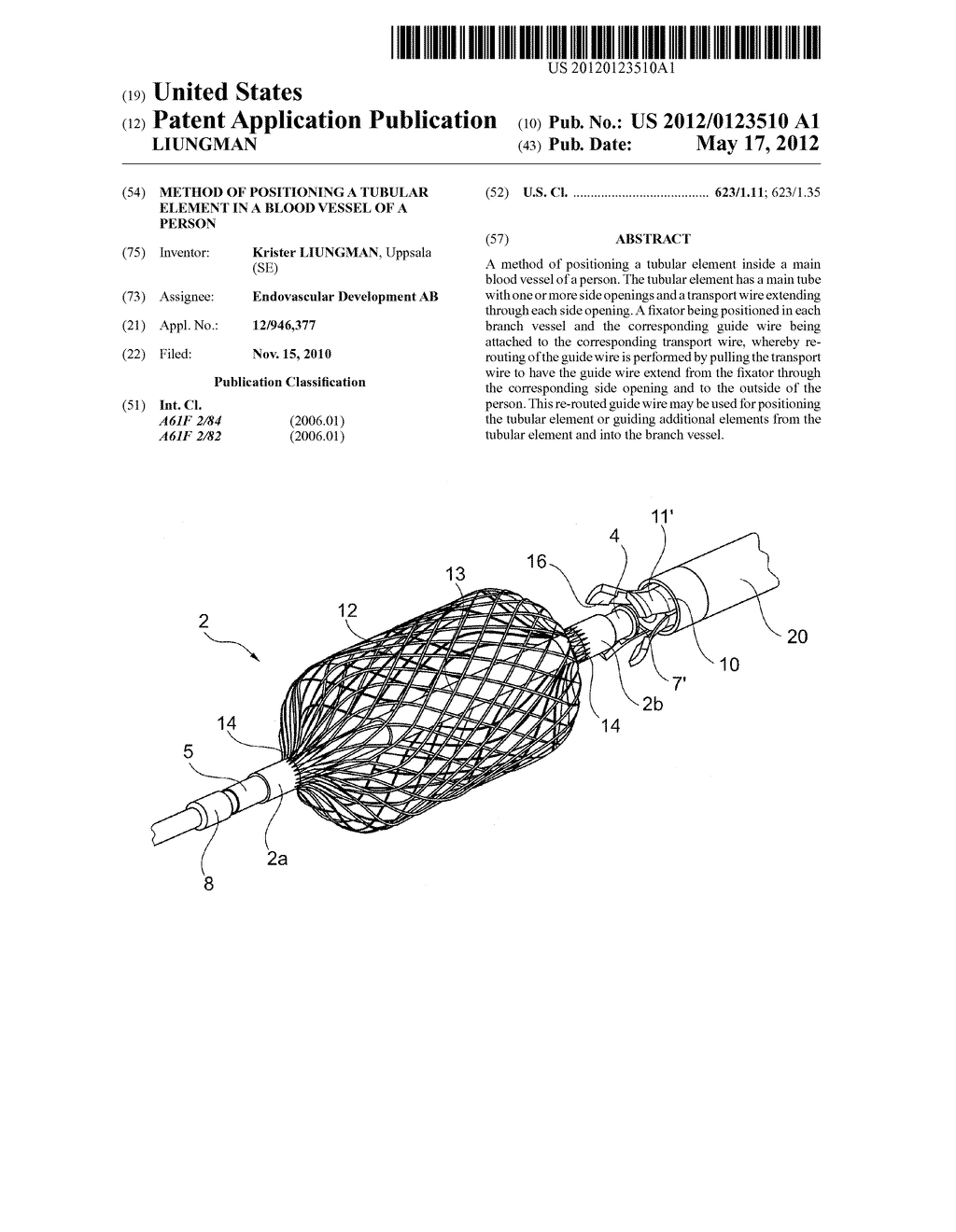 METHOD OF POSITIONING A TUBULAR ELEMENT IN A BLOOD VESSEL OF A PERSON - diagram, schematic, and image 01