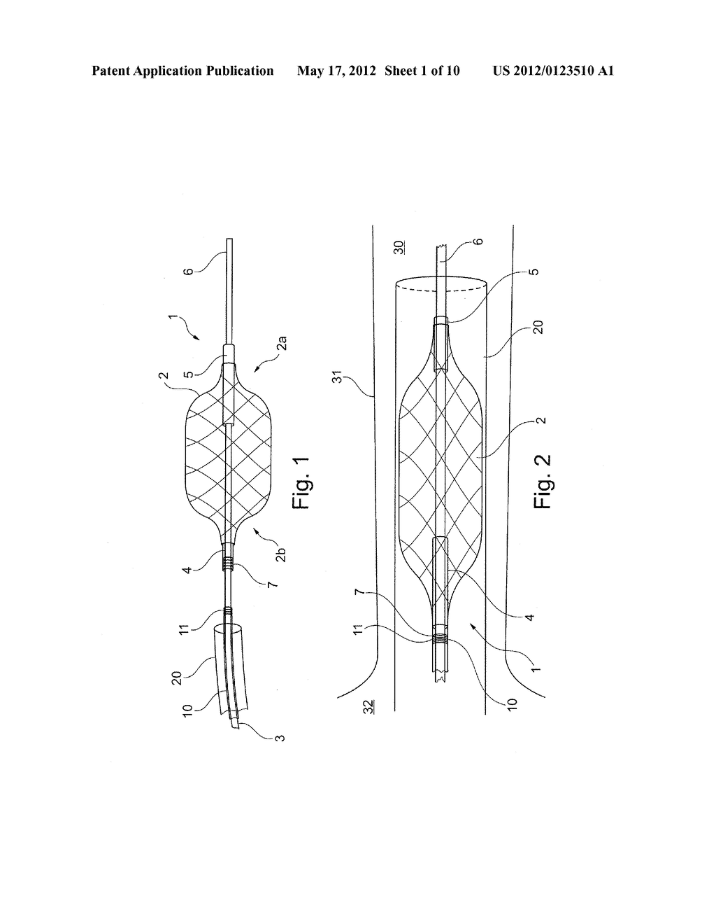 METHOD OF POSITIONING A TUBULAR ELEMENT IN A BLOOD VESSEL OF A PERSON - diagram, schematic, and image 02