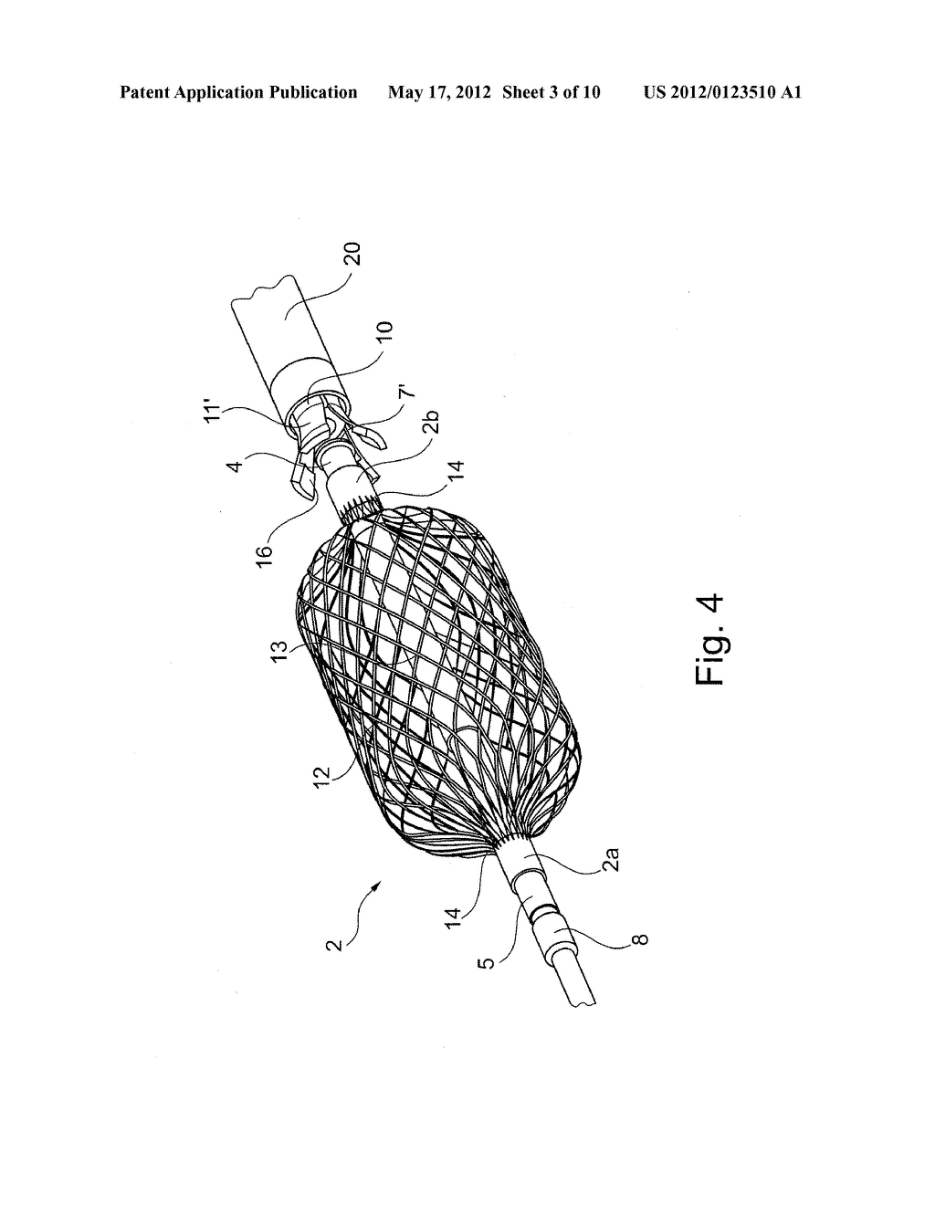 METHOD OF POSITIONING A TUBULAR ELEMENT IN A BLOOD VESSEL OF A PERSON - diagram, schematic, and image 04