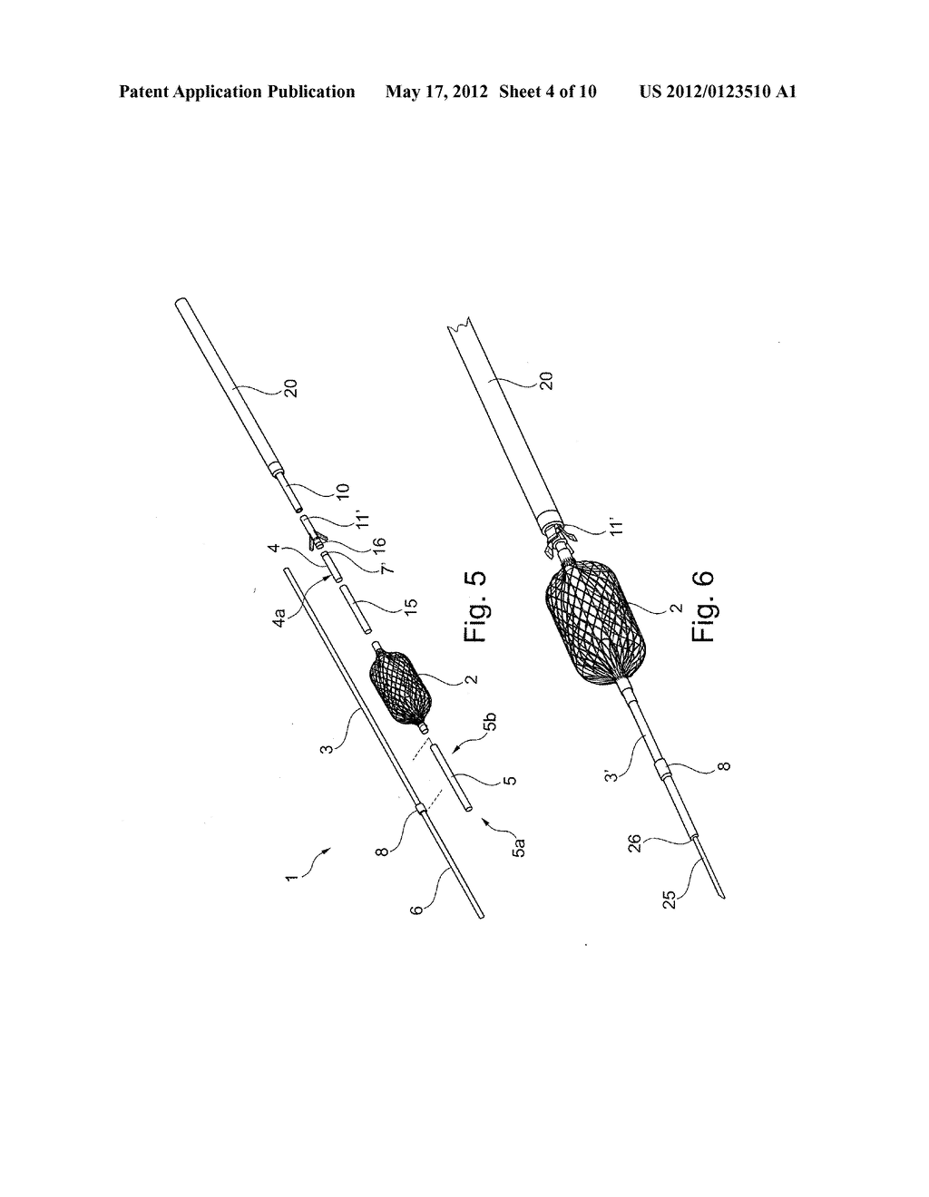 METHOD OF POSITIONING A TUBULAR ELEMENT IN A BLOOD VESSEL OF A PERSON - diagram, schematic, and image 05