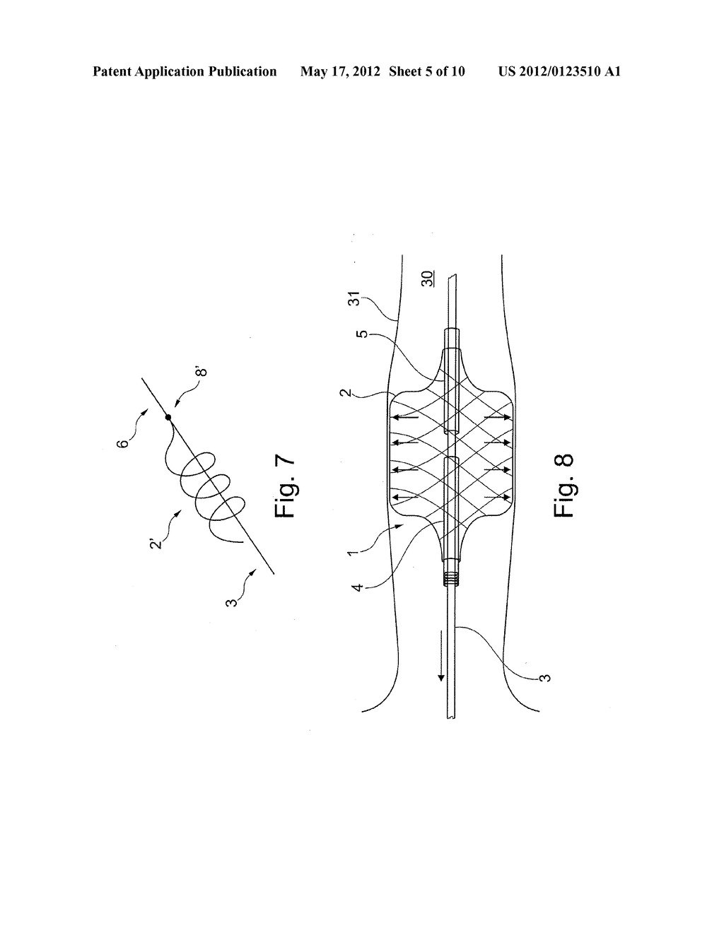 METHOD OF POSITIONING A TUBULAR ELEMENT IN A BLOOD VESSEL OF A PERSON - diagram, schematic, and image 06