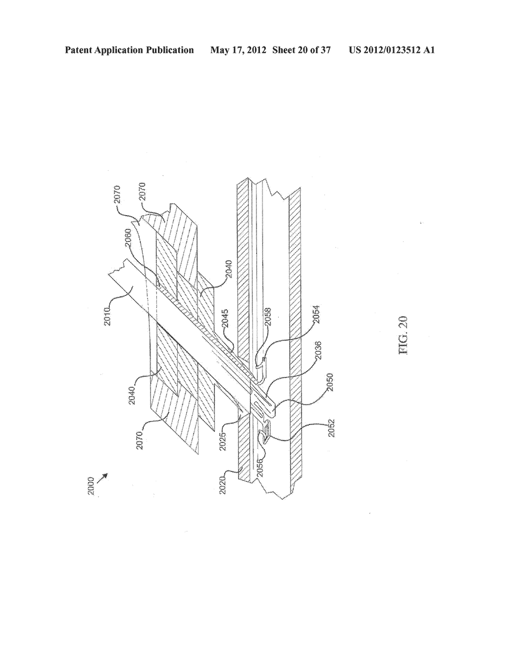 SUTURELESS VASCULAR ANASTOMOSIS CONNECTION - diagram, schematic, and image 21