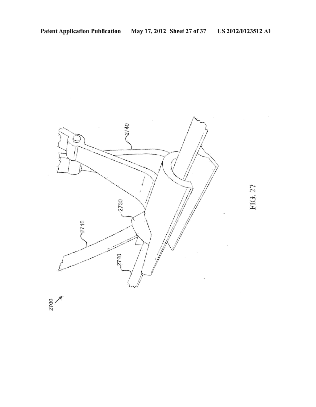 SUTURELESS VASCULAR ANASTOMOSIS CONNECTION - diagram, schematic, and image 28