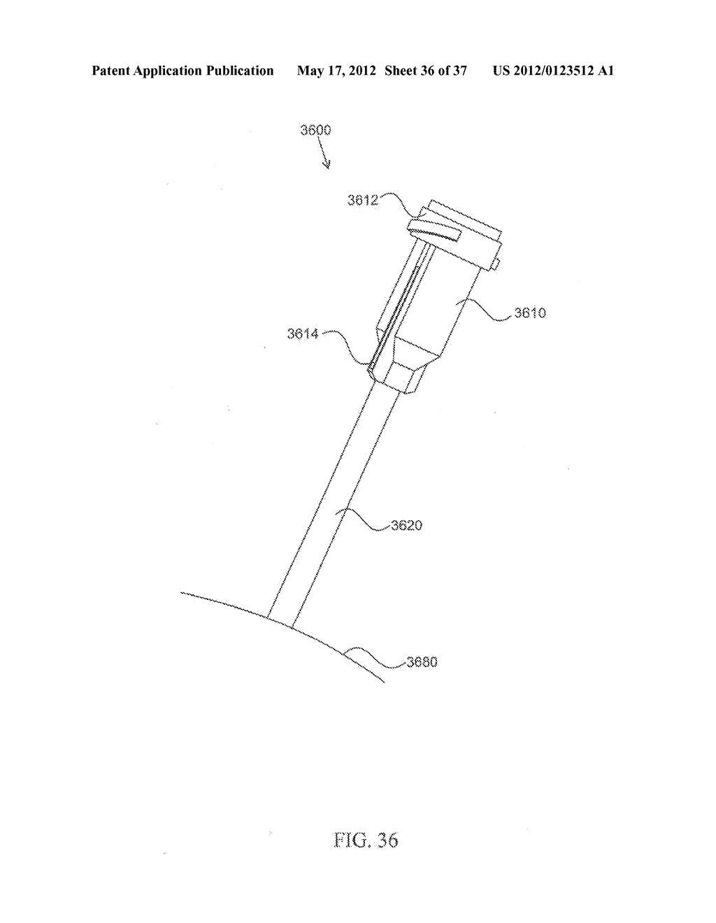 SUTURELESS VASCULAR ANASTOMOSIS CONNECTION - diagram, schematic, and image 37