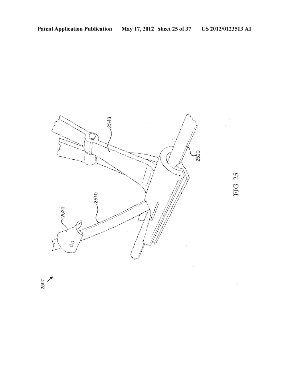 SUTURELESS VASCULAR ANASTOMOSIS CONNECTION - diagram, schematic, and image 26