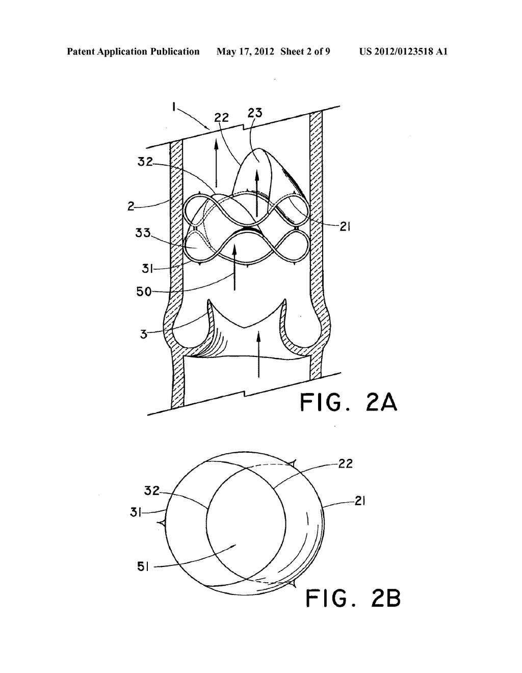 Flow-Deflecting Medical Device - diagram, schematic, and image 03