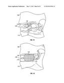 Intervertebral Spacer and Method of Installation Thereof diagram and image