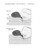 Zoned foam mattress with alternating lateral regions of HD foam and memory     foam diagram and image