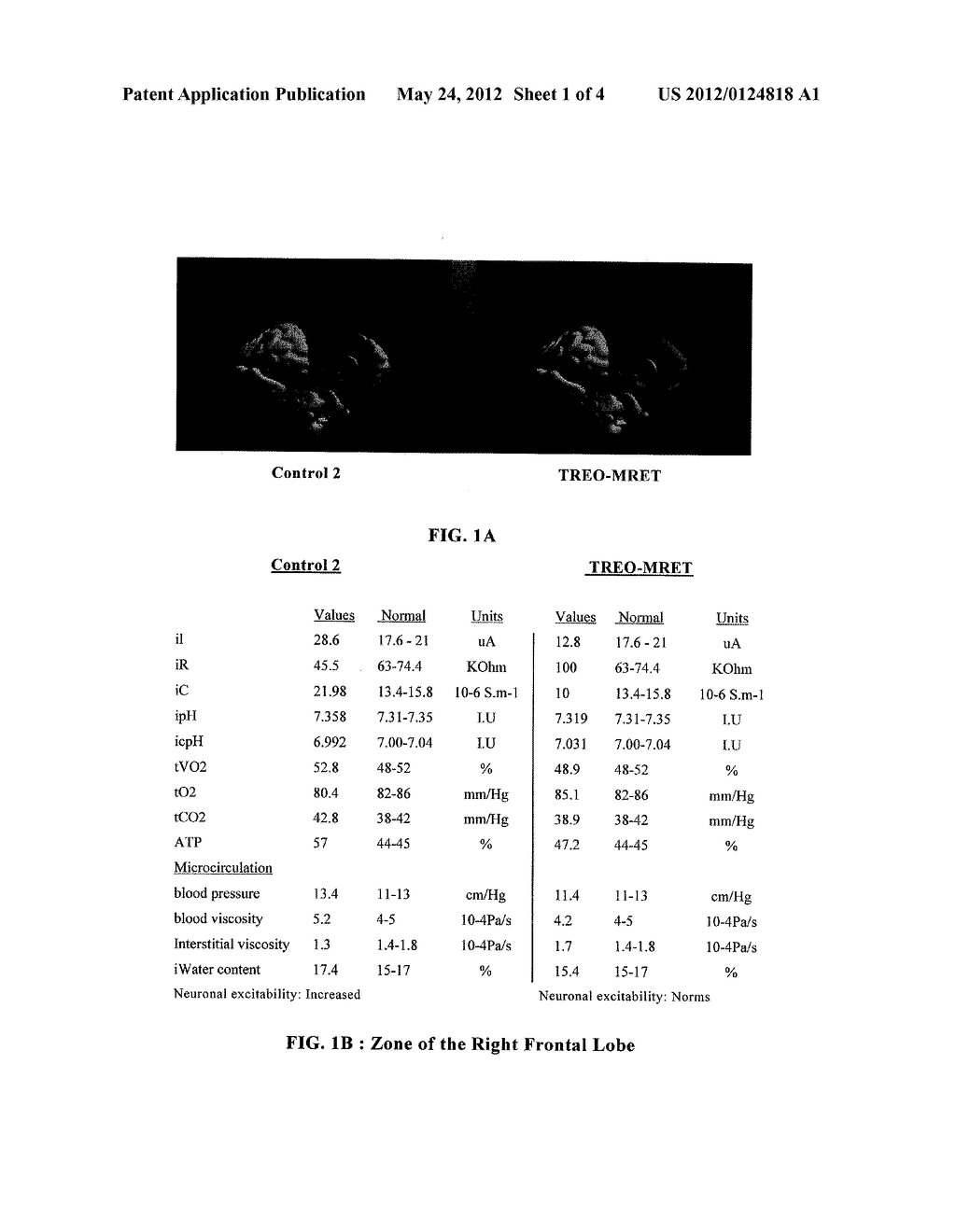 COMPOSITIONS FOR PROTECTION AGAINST ELECTROMAGNETIC RADIATION EXPOSURE - diagram, schematic, and image 02