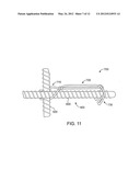 CLIP FOR JOINING REINFORCED MEMBERS FOR USE IN REINFORCED CONCRETE SLABS     AND/OR COLUMNS diagram and image