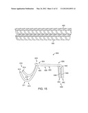 CLIP FOR JOINING REINFORCED MEMBERS FOR USE IN REINFORCED CONCRETE SLABS     AND/OR COLUMNS diagram and image