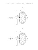 Dual-Inlet Supercharger for EGR Flow Control diagram and image