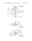 RATCHETING BOAT ANCHOR diagram and image