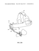 PATIENT INTERFACE ASSEMBLY AND SYSTEM USING SAME diagram and image