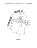 PATIENT INTERFACE ASSEMBLY AND SYSTEM USING SAME diagram and image