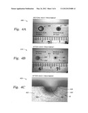 Method of producing a plasma-resistant thermal oxide coating diagram and image