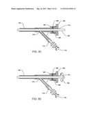 FLUID PRESERVATION SYSTEM AND METHOD FOR USE diagram and image