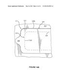 RESEALABLE CLOSURE WITH PACKAGE INTEGRITY FEATURE diagram and image