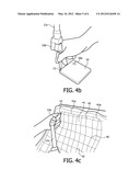 Method And Device For Manufacturing An Impression Of A Person-Specific     Contact Surface For  Sitting Orthosis diagram and image