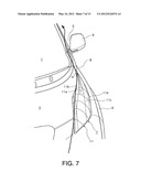 VEHICLE BOUNDARY LAYER AIR FLOW CONTROL STRUCTURE diagram and image