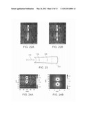 DEVICE FOR DETECTION OF AT LEAST ONE DEFECT IN A CONCAVE OR CONVEX     STRUCTURE diagram and image