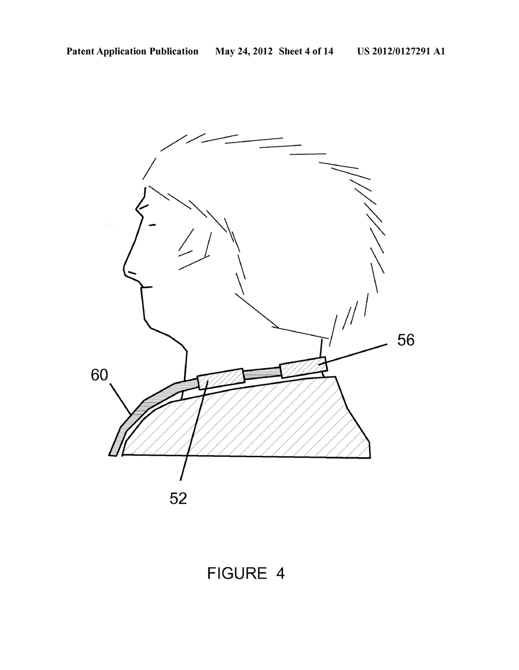 System And Method For Alerting Visually Impaired Users Of Nearby Objects - diagram, schematic, and image 05