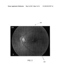 3D RETINAL DISRUPTIONS DETECTION USING OPTICAL COHERENCE TOMOGRAPHY diagram and image