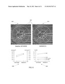 3D RETINAL DISRUPTIONS DETECTION USING OPTICAL COHERENCE TOMOGRAPHY diagram and image