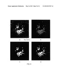 3D RETINAL DISRUPTIONS DETECTION USING OPTICAL COHERENCE TOMOGRAPHY diagram and image