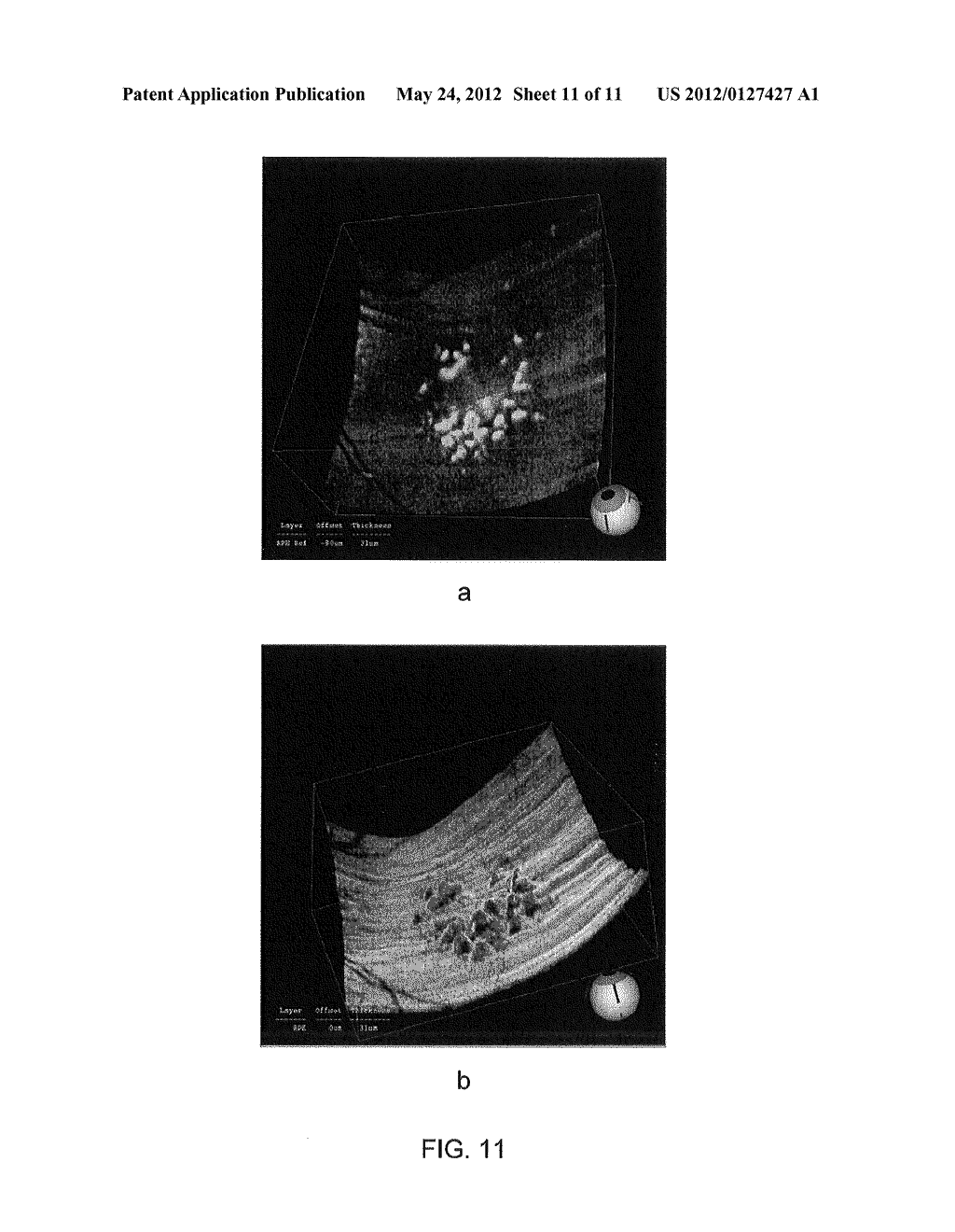 3D RETINAL DISRUPTIONS DETECTION USING OPTICAL COHERENCE TOMOGRAPHY - diagram, schematic, and image 12