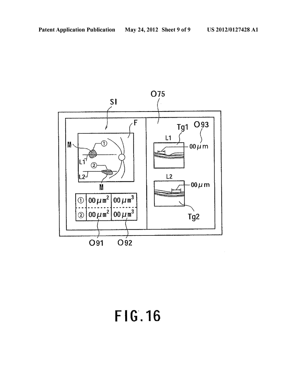 OPHTHALMIC PHOTOGRAPHING APPARATUS - diagram, schematic, and image 10