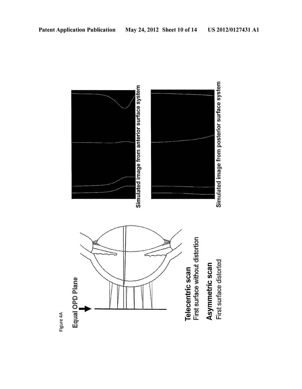 SCANNING OPTICAL SYSTEM FOR LARGE AXIAL SCAN DEPTH ANTERIOR SEGMENT     OPTICAL COHERENCE TOMOGRAPHY (OCT) - diagram, schematic, and image 11