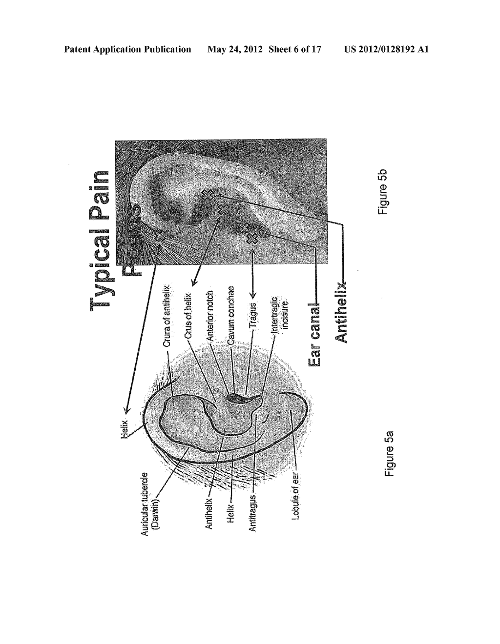 EARPIECE SYSTEM - diagram, schematic, and image 07