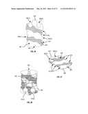 Ergonomic System For Compact Winding And Storage Of Earphone     Set/Headphones Used With Digital Media Devices diagram and image