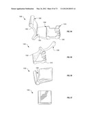 Ergonomic System For Compact Winding And Storage Of Earphone     Set/Headphones Used With Digital Media Devices diagram and image