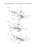 Ergonomic System For Compact Winding And Storage Of Earphone     Set/Headphones Used With Digital Media Devices diagram and image