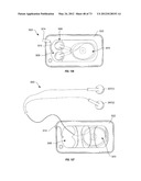 Ergonomic System For Compact Winding And Storage Of Earphone     Set/Headphones Used With Digital Media Devices diagram and image