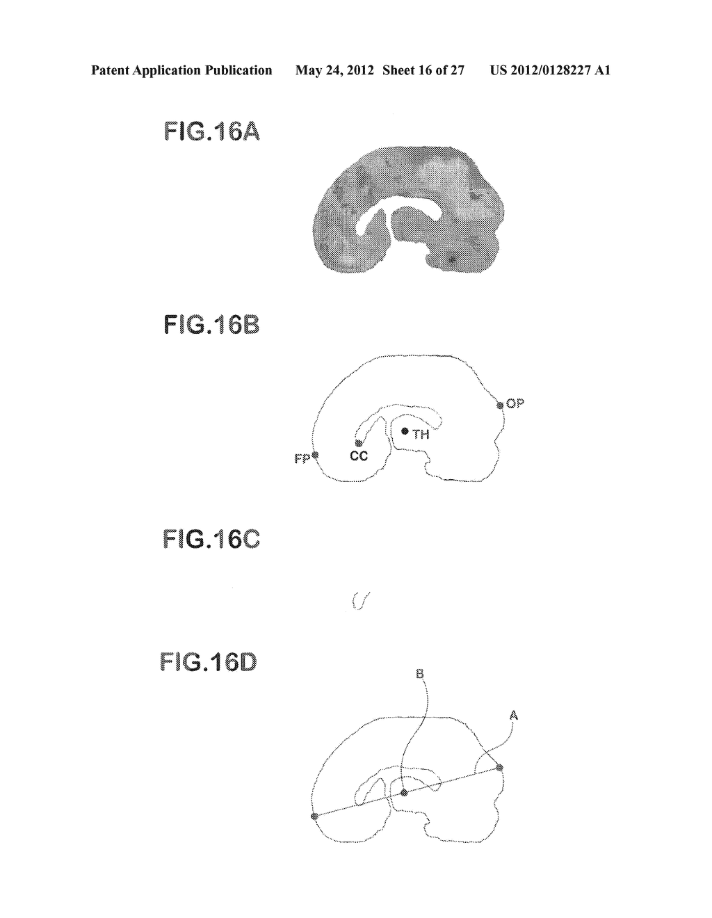 DEVICE FOR GENERATING ALTERNATIVE OF NORMAL BRAIN DATABASE - diagram, schematic, and image 17