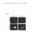 THERAPEUTIC AGENTS FOR ALZHEIMER S DISEASE AND CANCER diagram and image