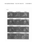 THERAPEUTIC AGENTS FOR ALZHEIMER S DISEASE AND CANCER diagram and image