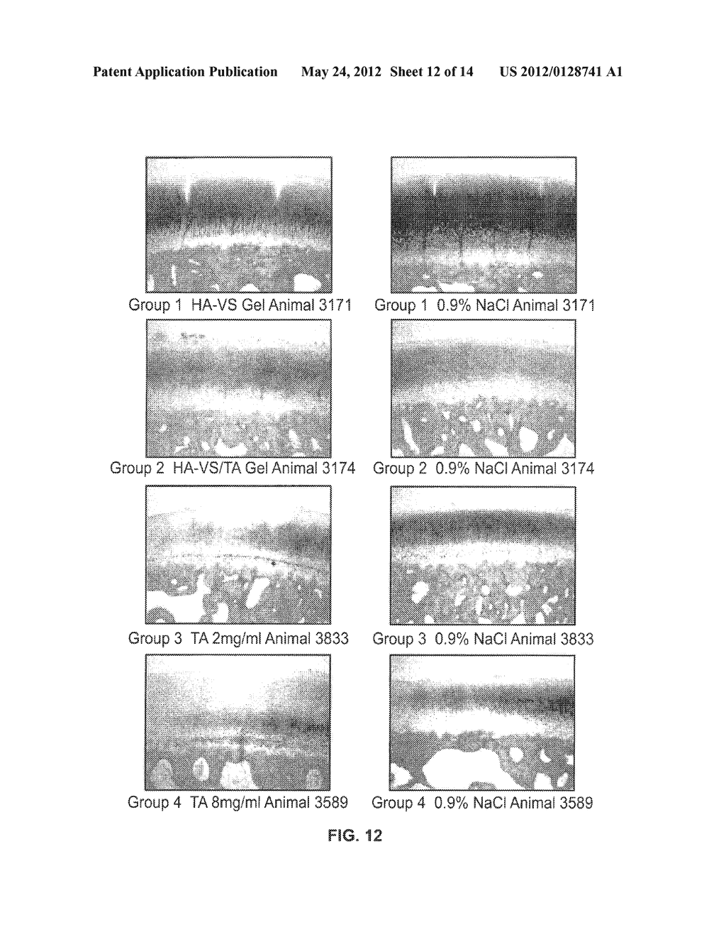 MODIFIED HYALURONIC ACID POLYMER COMPOSITIONS AND RELATED METHODS - diagram, schematic, and image 13