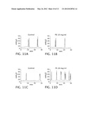 Sphingomyelin Liposomes for the Treatment of Hyperactive Bladder Disorders diagram and image