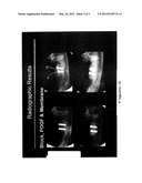 MAXILLOFACIAL BONE AUGMENTATION USING RHPDGF-BB AND A BIOCOMPATIBLE MATRIX diagram and image