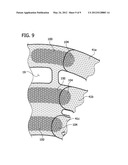 COMPRESSION DEVICE WITH WEAR AREA diagram and image