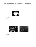 METHOD FOR ENCAPSULATING LIQUID OR PASTY SUBSTANCES IN A CROSS-LINKED     ENCAPSULATION MATERIAL diagram and image