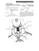 Removable Rodent Intraoral Device diagram and image