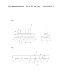 Orthodontic Treatment Tube diagram and image