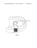 MULTI-COORDINATE ORTHODONTIC IMPLANT POSITIONING DEVICE diagram and image