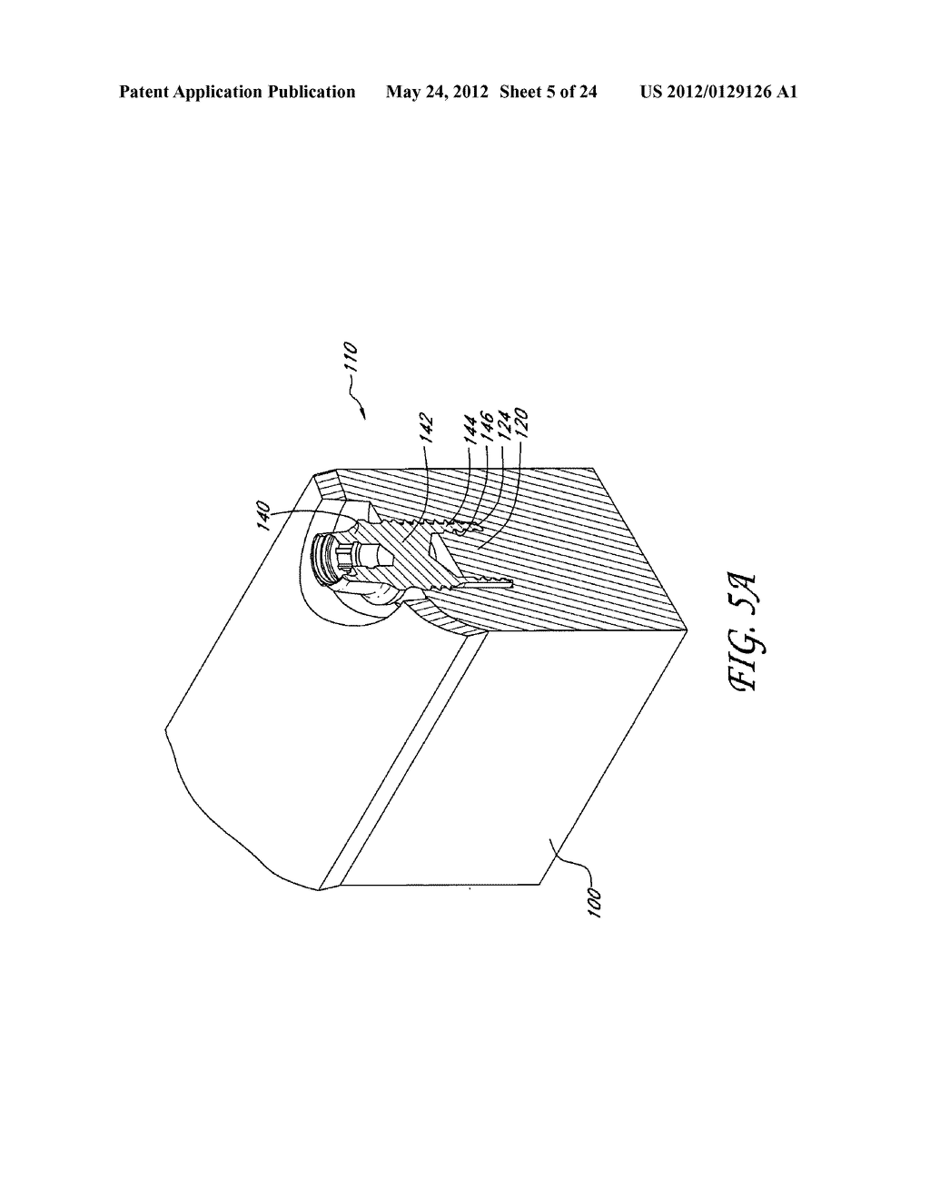 DEVICE AND PROCEDURE FOR IMPLANTING A DENTAL IMPLANT - diagram, schematic, and image 06