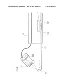 ENDOSCOPE SYSTEM diagram and image